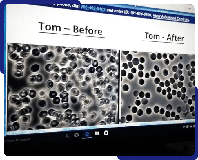 A computer screen showing the same image of a before and after picture.